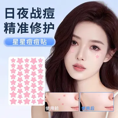 Xingxing akne bandı yıldız şekli teriye dayanıklı makyajlanabilir - 8
