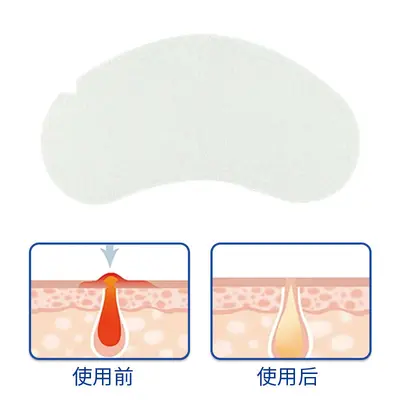 Invisible Forehead and Nose Strips, Peel-Off T-Zone Pore Care - 10