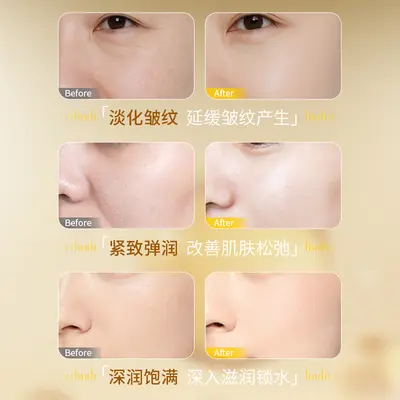 Yiyang Küçük Moleküler Hyaluronik Asit Tek Kullanımlık Nemlendirici Serum