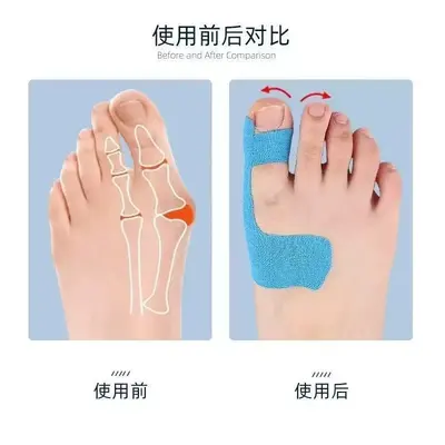 Toe Corrector Disposable Gel Pad Pre-Cut Elastic Support for Bunion Hallux Valgus Fixation Sports Tape
