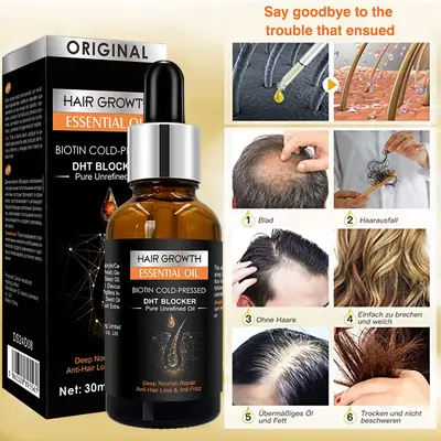 Ingwer-Haaröl, Kopfhautpflege, spülfreies Massageöl - 3
