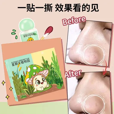 去黑头小绿膜套装深层清洁鼻贴鼻头贴细粉刺收缩毛孔神器厂家正品