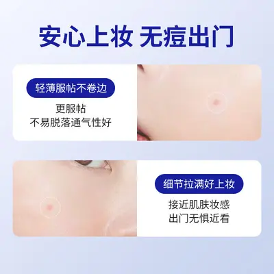 费特蒙痘痘贴医用隐形净痘贴祛痘贴创口贴水胶体无菌敷料72贴