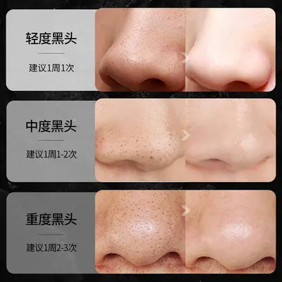Lubishi Blackhead Removal Set, Nose Strips and Cleansing Mask - 4