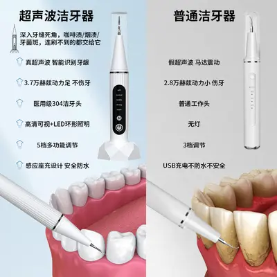 可视超声波洁牙器 家用电动牙结石去除器 口腔清洁美牙仪跨境专供