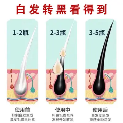 何首乌白发转黑发精华液滋养毛囊营养液生长发液防脱精华乳育发液 - 4