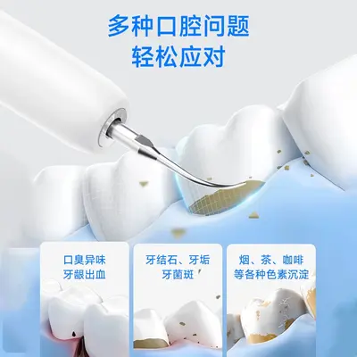 HYUNDAI超声波洁牙器家用5模式牙结石去除神器超声波洗牙器美牙仪