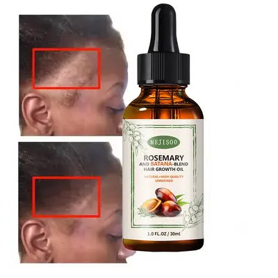 Rosemary Batana Blend Haarwuchsöl - 4