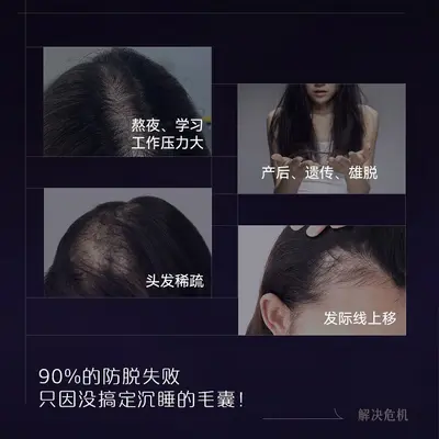 头皮按摩梳电动头皮上药器电流梳红光导液梳头部按摩神仪器家用