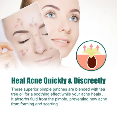 EELHOE Star-Shaped Acne Patches, Gentle Facial Cleansing Care