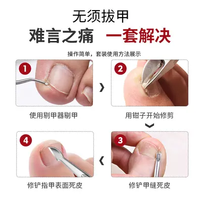 Nagelschere Set mit breiter Zange für abgestorbene Haut - 5
