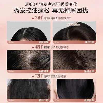 二硫化硒洗发水一件起批正品去屑止痒控油沐浴露香水型味持久留香 - 5