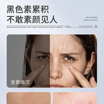 377 Aufhellungs- und Fleckenentferner Second Serum Essence Niacinamid Original Solution Feuchtigkeits- und Feuchtigkeits-Essence Hautpflege Produkte Second Serum Essence - 4