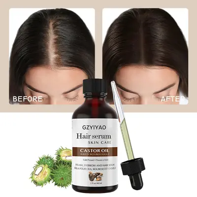 Kopfhaut-Haaröl-Serum, Haarverlängerung, Pflege, Verdichtung