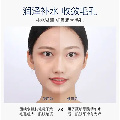 Xingxiangmei Hyaluronik Asit Ampul Esansı, Nemlendirici ve Sıkılaştırıcı, Büyük Boy