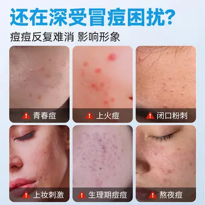 Changbaishan Ultra-Thin Star Hydrocolloid Acne Patches, 40 Pcs - 2