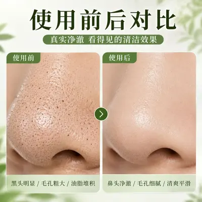水杨酸清洁泥膜去黑头泥膜去粉刺面膜深层清洁肌肤果酸收缩毛孔霜