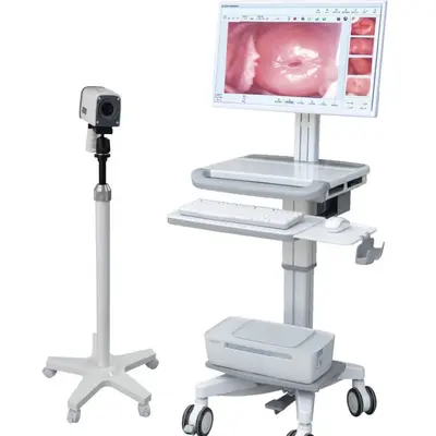 Medical Electronic Digital Colposcope for Gynecological Examination with Sony Imported Camera Head High-Definition Endoscope Direct from Manufacturer - 5