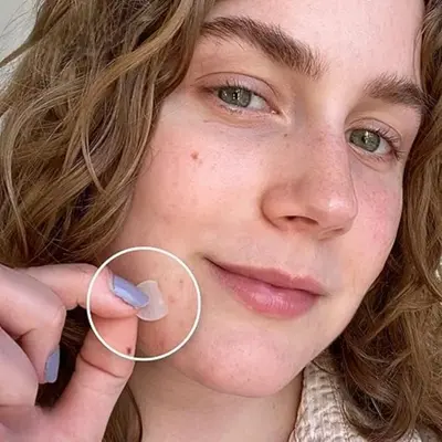 Transparente Akne-Patches, 720er, mehrere Größen