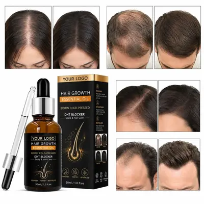 Ingwer-Haarwuchsöl mit Jojobaöl, 30 ml - 4