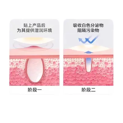 星星痘痘贴型遮盖痘印隐形可上妆防汗水可爱物理吸脓水胶体痘印贴