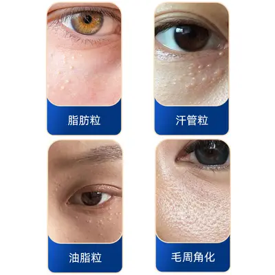 Yunnan Bitkisel Cilt Yağı, Göz Çevresi Yağ Tanecik Giderici - 4