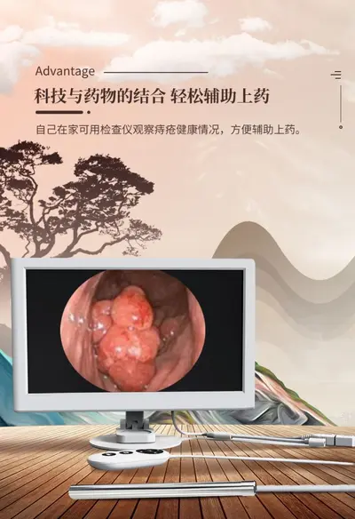 Rectal Endoscope Ultra HD 10 Inch Portable Inspection Camera - 7