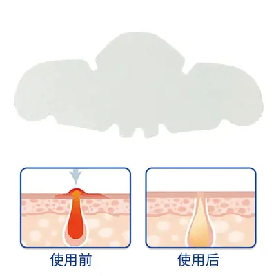 Invisible Forehead and Nose Strips, Peel-Off T-Zone Pore Care - 9