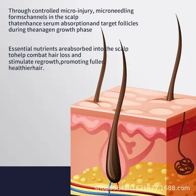Infusion Hair Regrowth Kit, Yoğun Saç Büyütücü Mikro İğneli Serum Seti - 5
