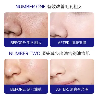 Salicylic Acid Acne Pore-Minimizing Mask Sheet