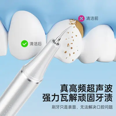 源头工厂5件套家用超声波洁牙器冲烟渍牙洗牙器口腔清洁套装批发