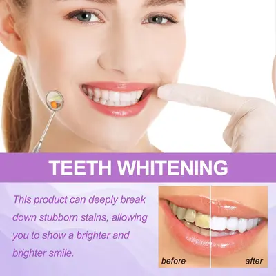 Jaysuing Purple Bright White Teeth Strips Remove Yellowing and Stains Deep Cleaning Oral Health Care Teeth Whitening Strips - 4