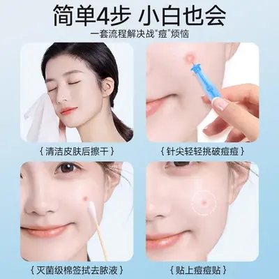 海氏海诺一次性无菌粉刺针独立辐照灭菌挑痘闭口痘痘脂肪粒暗疮针