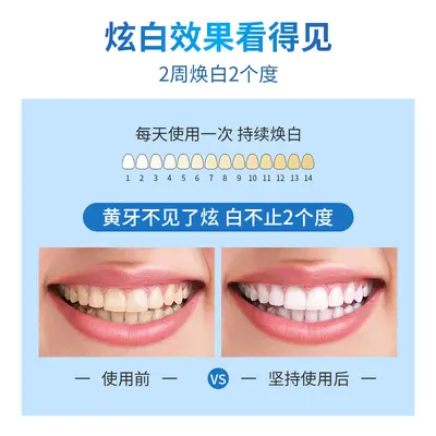 5D Whitening Teeth Strips, Removes Yellow Stains, 7 Pairs / 14 Pairs - 2