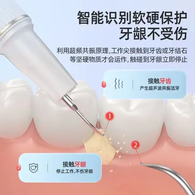 可视超声波洗牙器牙结石去除器五档牙垢口腔清洁美白护齿洁牙器