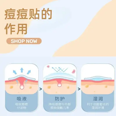 Two-Color Essential Oil Acne Patch, Portable, Individually Packaged - 3