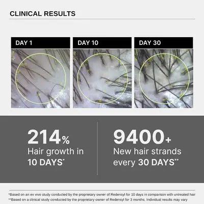 Biberiyeli Saç Büyütücü Serum, Unisex, Advanced Hair Growth Serum - 3