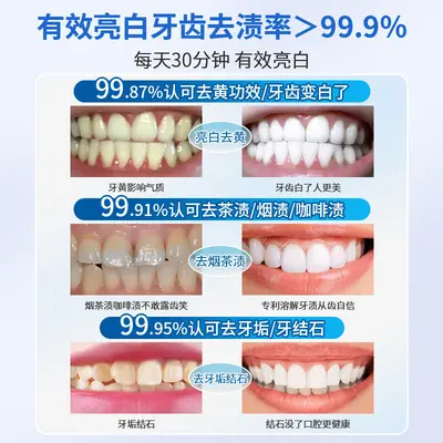 美白牙贴WHITE炫白牙贴3D5D9D牙齿美白去黄脱色贴7对14对一件代发