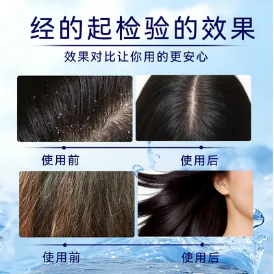 Pflanzliches Anti-Schuppen-Shampoo mit Kopfhautpflege - 4