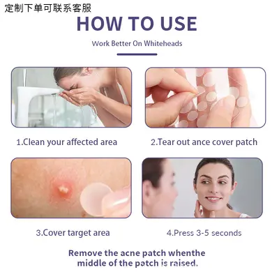 Hydrocolloid Colored Acne Patches, Invisible and Makeup-Compatible - 5