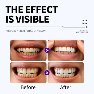 V34 Teeth Whitening Strips, Purple, Tooth Stain Removal - 5