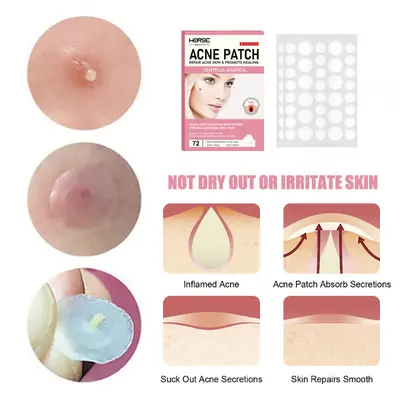 Ultra-Thin Invisible Acne Patches, Acne Mark Concealing, Strong Absorbing - 4