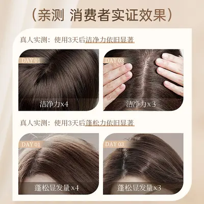 Selenium Disulfide Anti-Dandruff Shampoo Anti-Itch Oil Control - 4