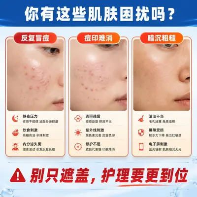 Jiyixing Hong Kong Acne Cream for Acne Marks - 3