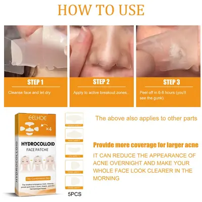 EELHOE hydrogel acne patch, portable, invisible