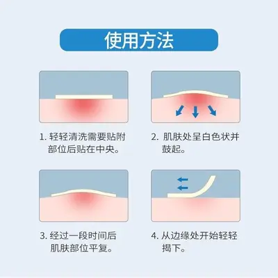 保真正品韩国OliveYoung欧利芙洋痘痘贴隐形净痘贴遮瑕痘印102贴 - 4