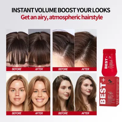 Cross-border Exclusive Meidian Oil Head Fluffy Magic Volumizing Hair Powder, Hair Volume Powder for Oil Control, Fluffy Bangs Dry Shampoo Powder, Oil-Absorbing Hair Setting Powder - 5