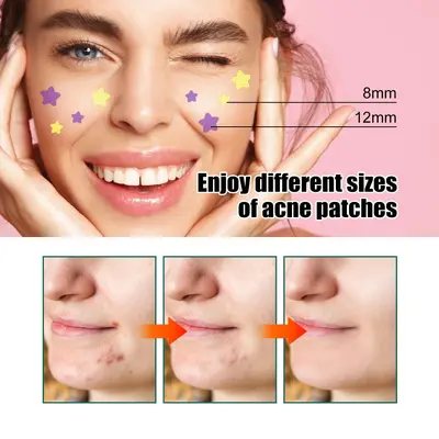 EELHOE Star-Shaped Acne Patches, Gentle Facial Cleansing Care