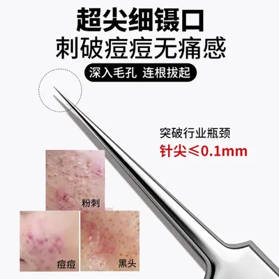 Ultra-Fine Comedone Extractor Tweezers, Blackhead and Pimple Tool