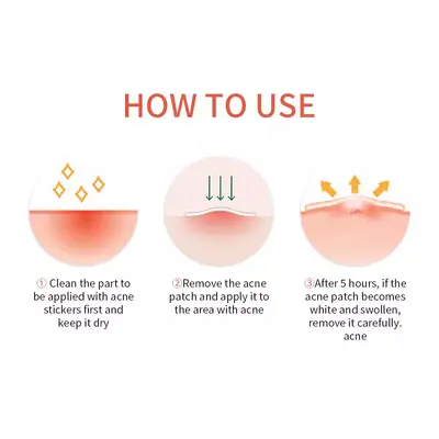 Youbuy acne patches, 36 pieces, day and night use - 3